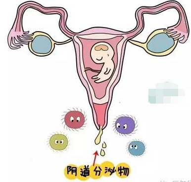 阴道分泌物JK漫画在线观看的一般性状检查类型