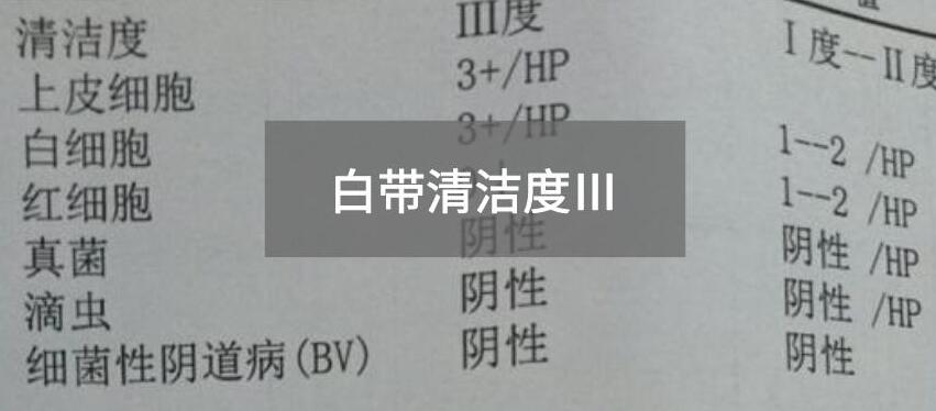 今天快讯！全自动白带JK漫画软件APP生产厂家JK漫画下载APP为您官方解释白带清洁度3的意思
