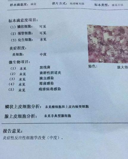 阴道分泌物JK漫画在线观看厂家教你查看阴道分泌物检测报告