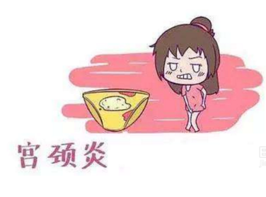 妇科白带JK漫画在线观看厂家分析宫颈炎的症状