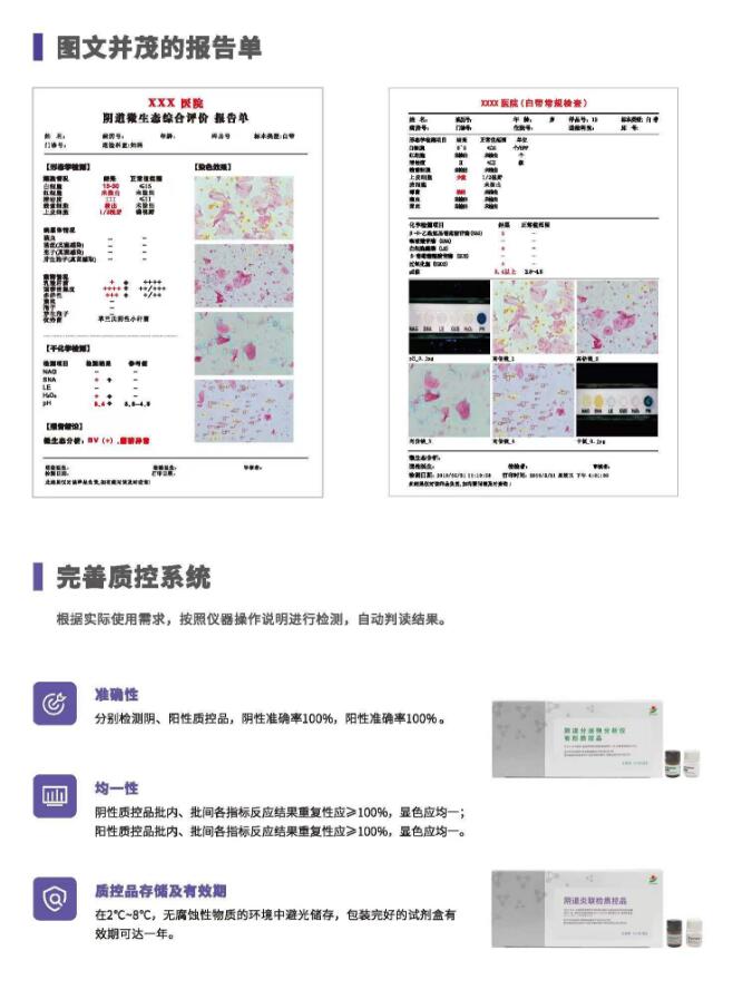 阴道分泌物JK漫画软件APPV800报告单